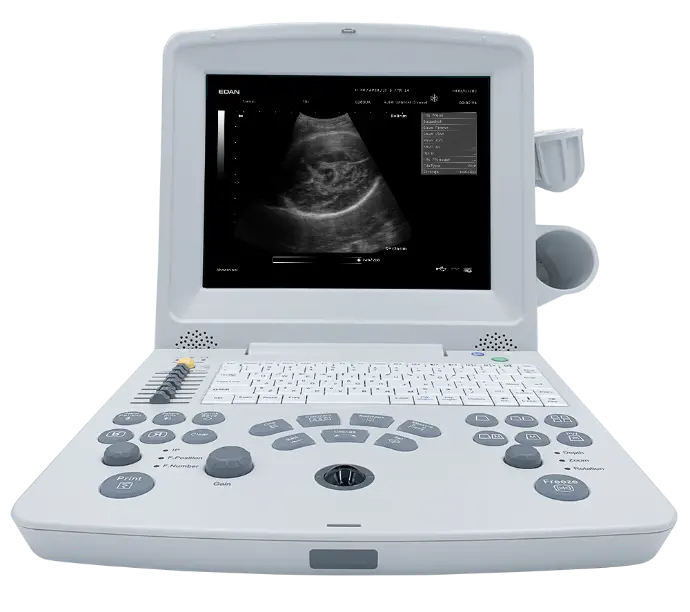 SISTEMA DE EXPLORACIÓN POR ULTRASONIDO DUS60