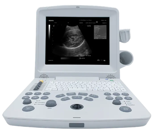 [1-004-00019] SISTEMA DE EXPLORACIÓN POR ULTRASONIDO DUS60